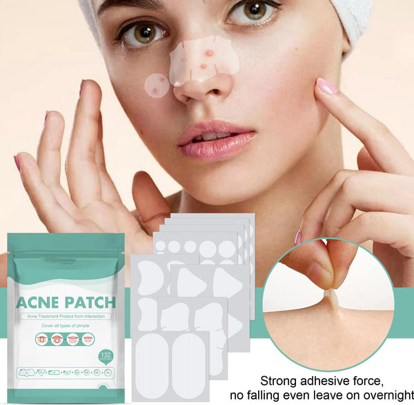 Acne Removing Patch To Fade And Remove Acne